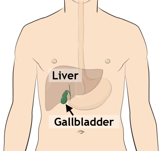 Gallbladder Disease – Treatment and Surgical Options with daVinci ...